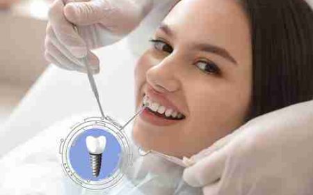 Say Goodbye to Dentures: Embrace Permanent Dental Implants